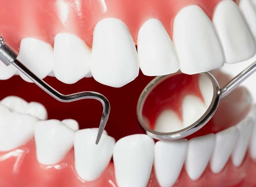 Periodontoloji (Diş Eti Hastalıkları)