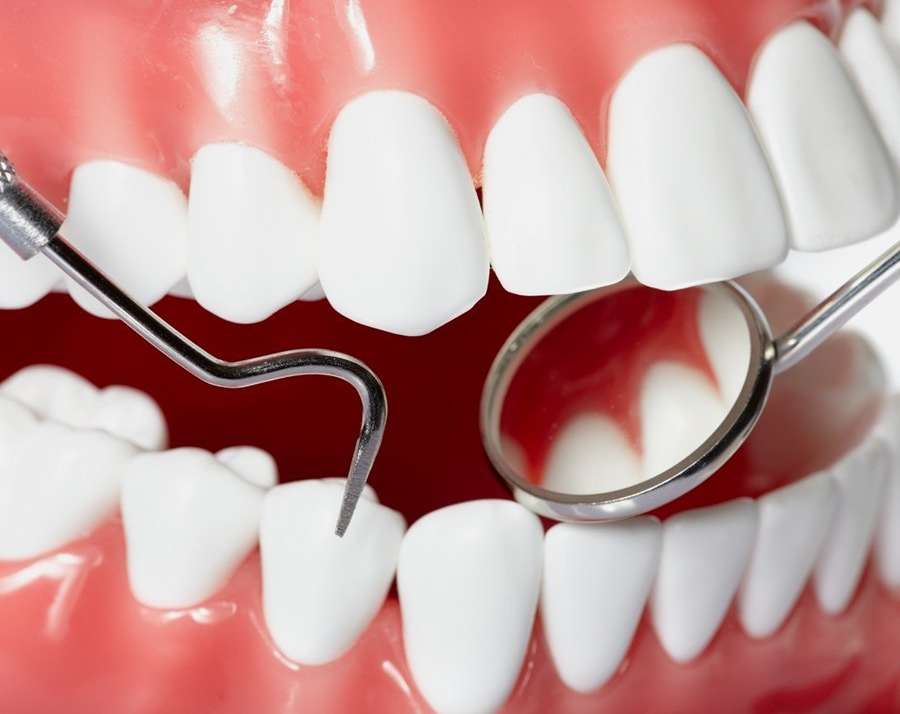 Periodontoloji (Diş Eti Hastalıkları)